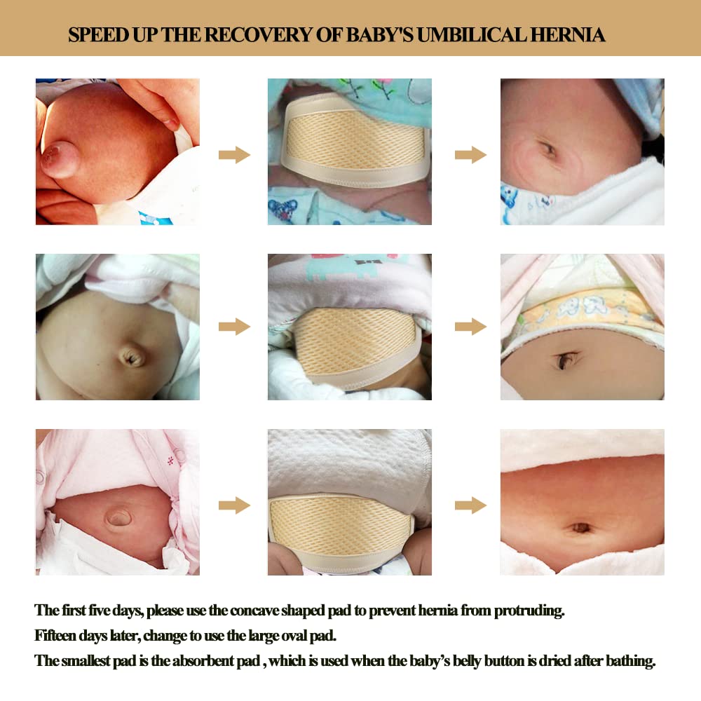 Umbilical Hernia Belt Baby/Infant Belly Button Band Wrap Truss Abdominal Binder for Children Kids Support Adjustable Navel Band Newborn Umbilical Cord 15-20 inch - Image 7